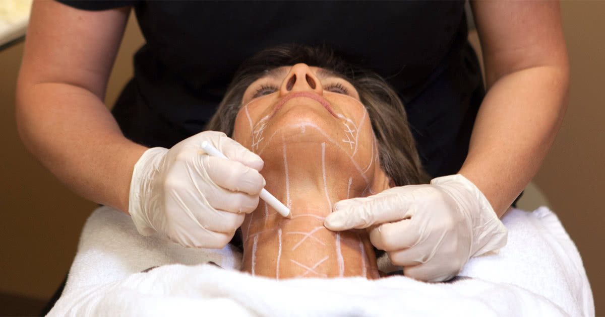 Non-invasive facelift performed by a healthcare professional