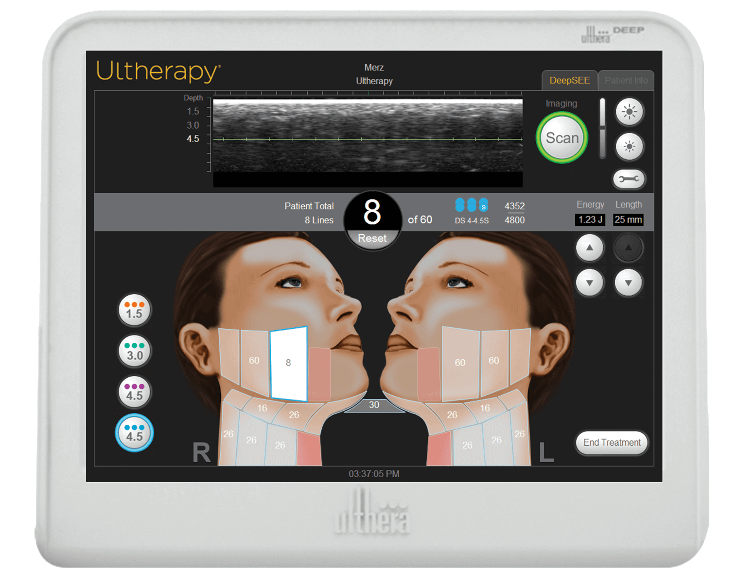Touchscreen control unit for effective Ultherapy treatments