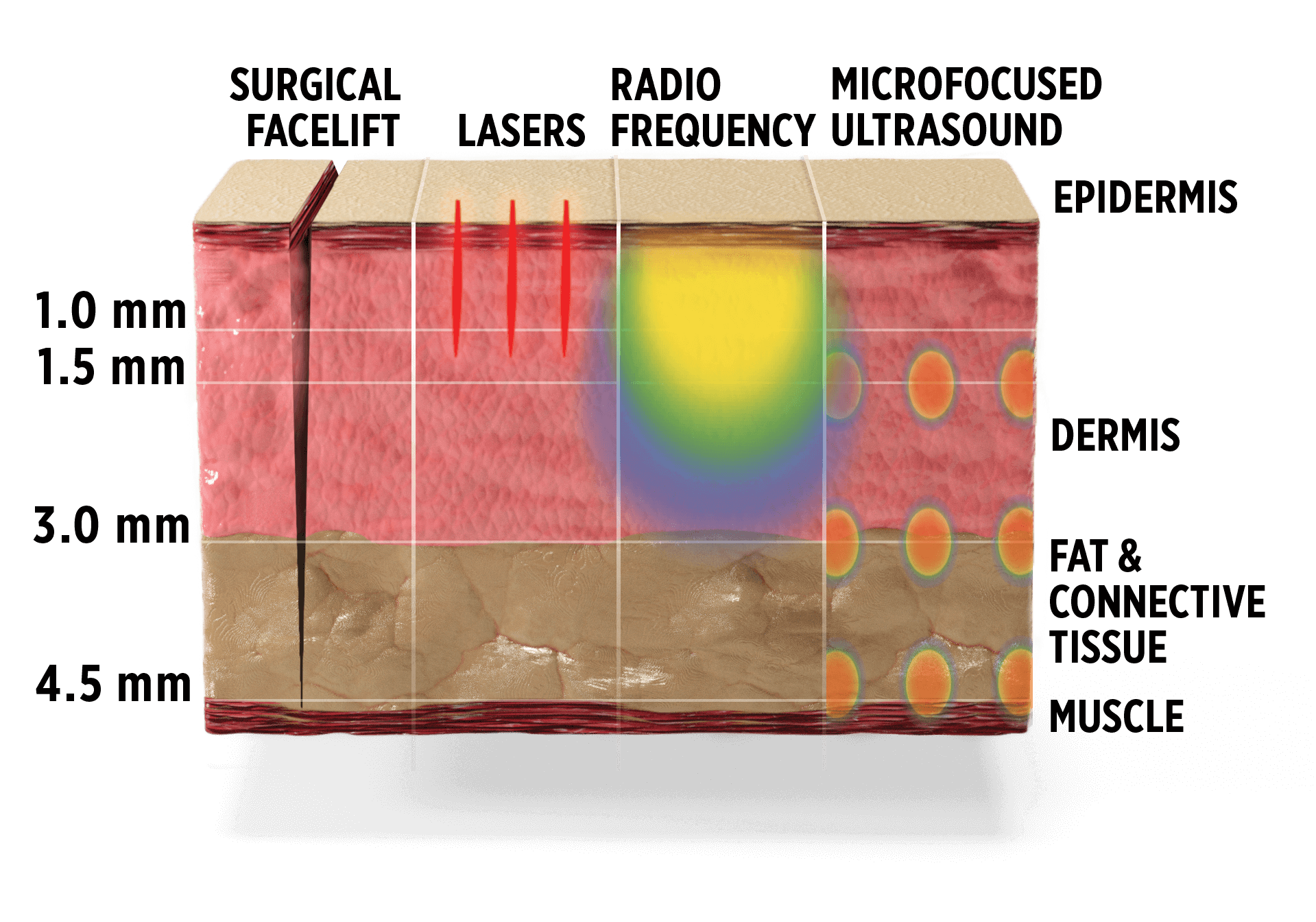 skin layer cross-section