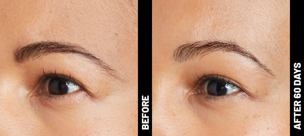 erin, brow results after 60 days