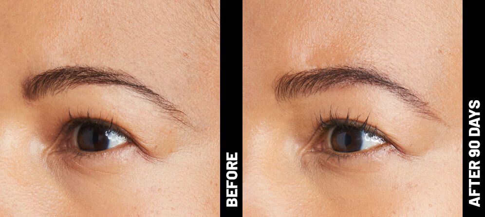erin, brow results after 90 days