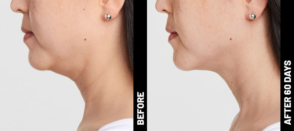 grace, profile results after 60 days