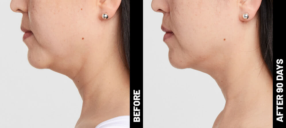 grace, profile results after 90 days