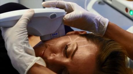 Procedure Up Close Ultherapy Skin Lifting Treatment